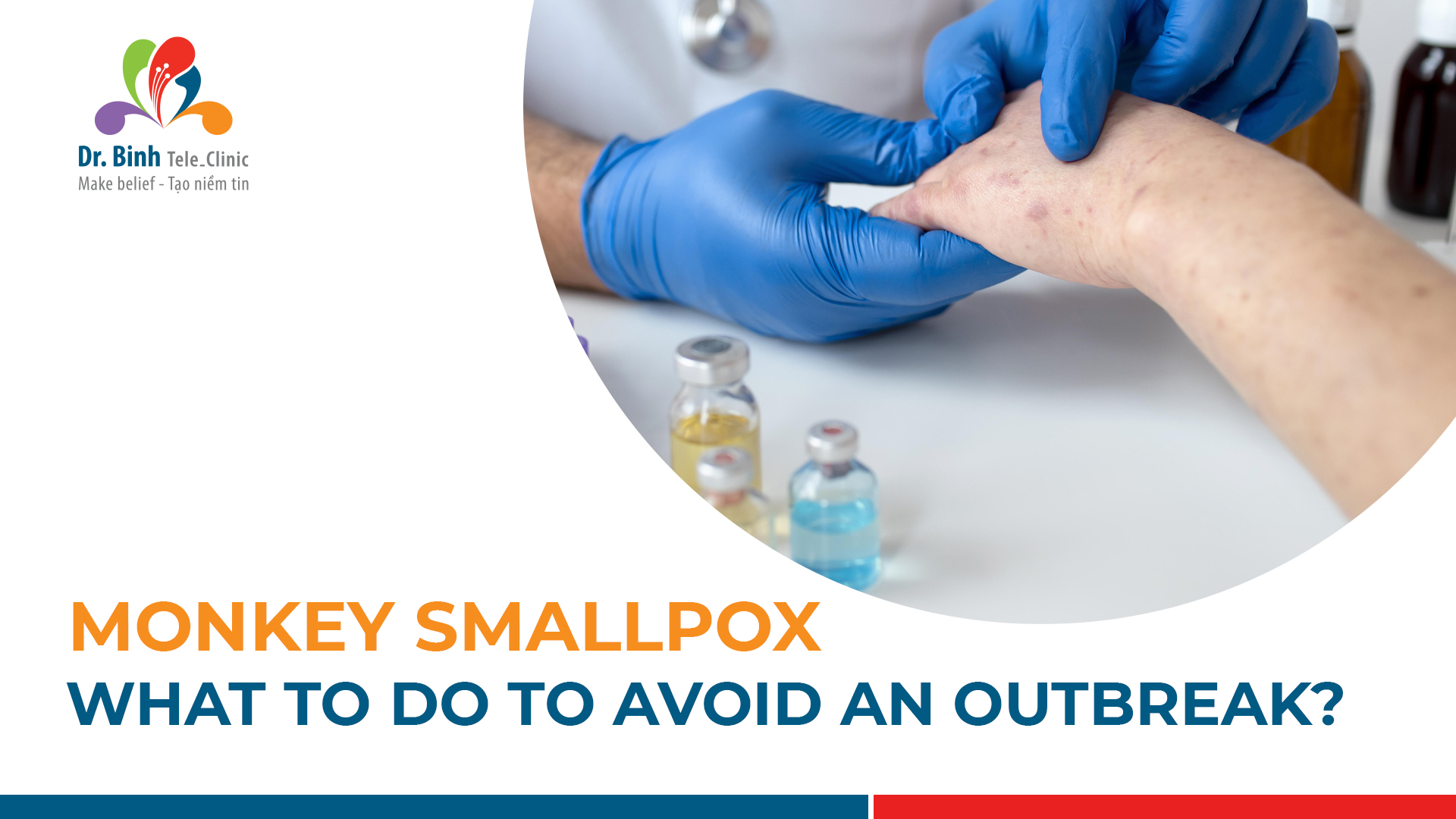 What-to-do to prevent-monkeypox?