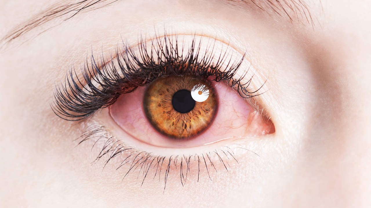  symptoms-of-eye-disease