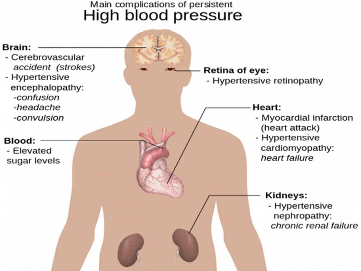  symptoms-of-high-blood-pressure