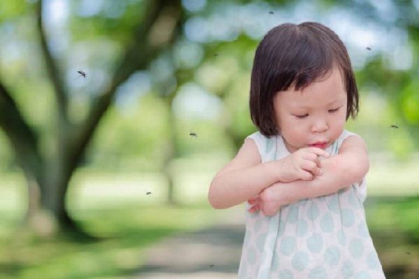 Bí quyết loại bỏ vết muỗi đốt cực kỳ đơn giản bạn cần biết.