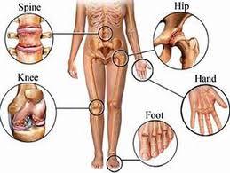 Vật lý trị liệu thoái hóa khớp gối