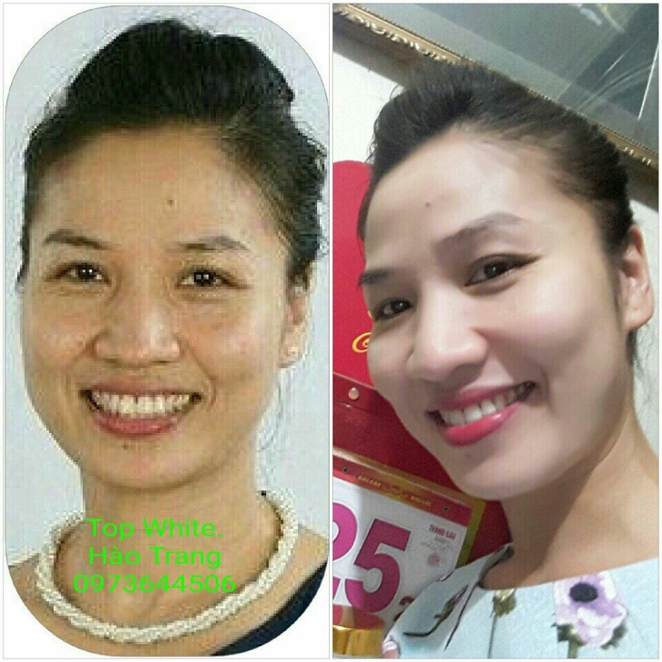 “MỜ TUỔI TÁC” CÙNG TRỌN BỘ SẢN PHẨM DƯỠNG DA TOÀN DIỆN TOP WHITE