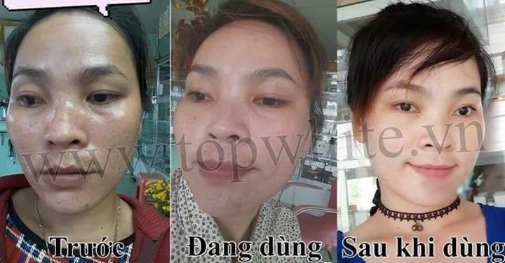 🔖🔖🔖 5 THÁNG DÙNG TOP WHITE, CUỘC ĐỜI TÔI ĐÃ THAY ĐỔI ❗❗❗