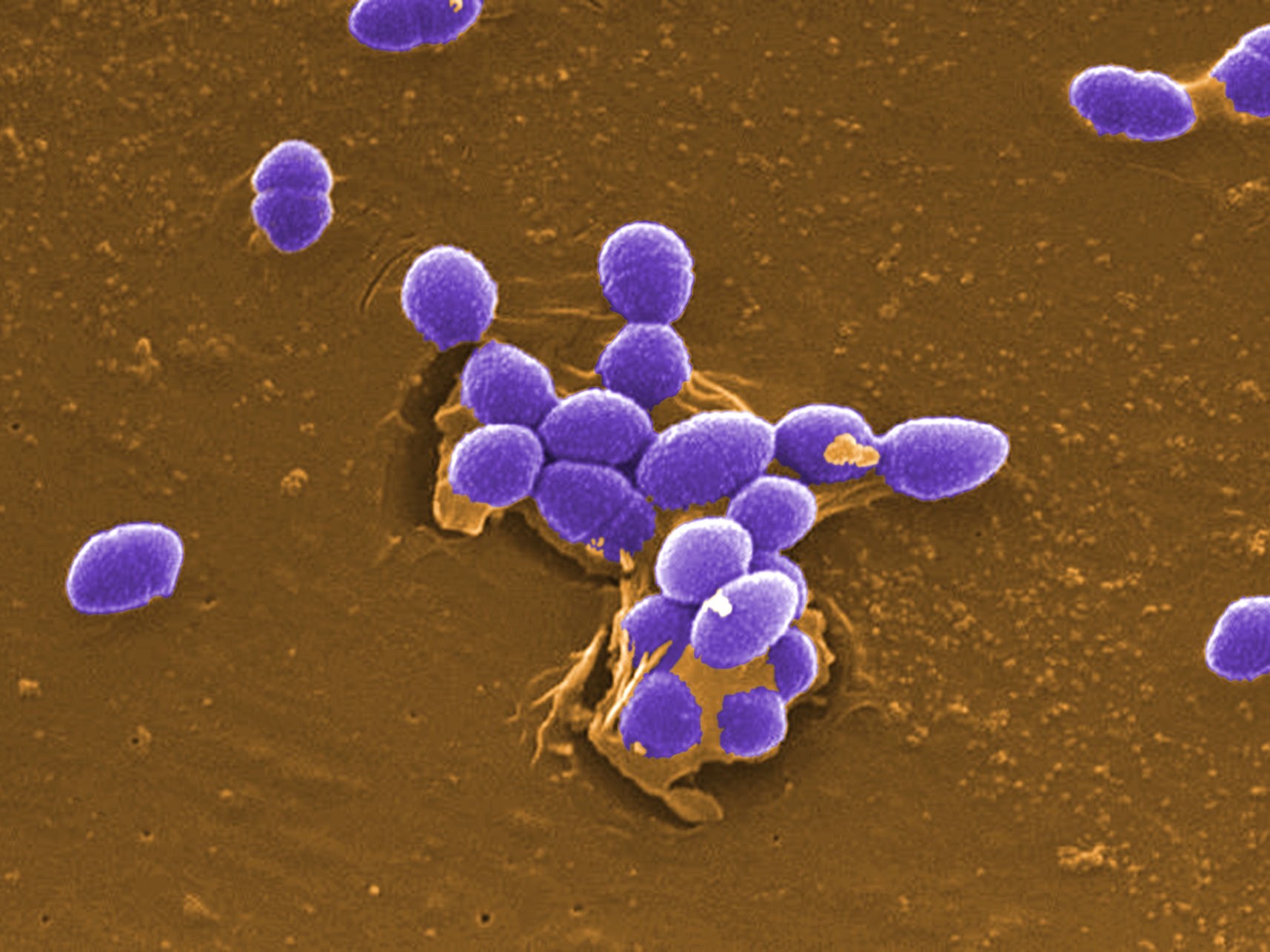 KHUẨN CẦU RUỘT KHÁNG VANCOMYCIN (VRE)