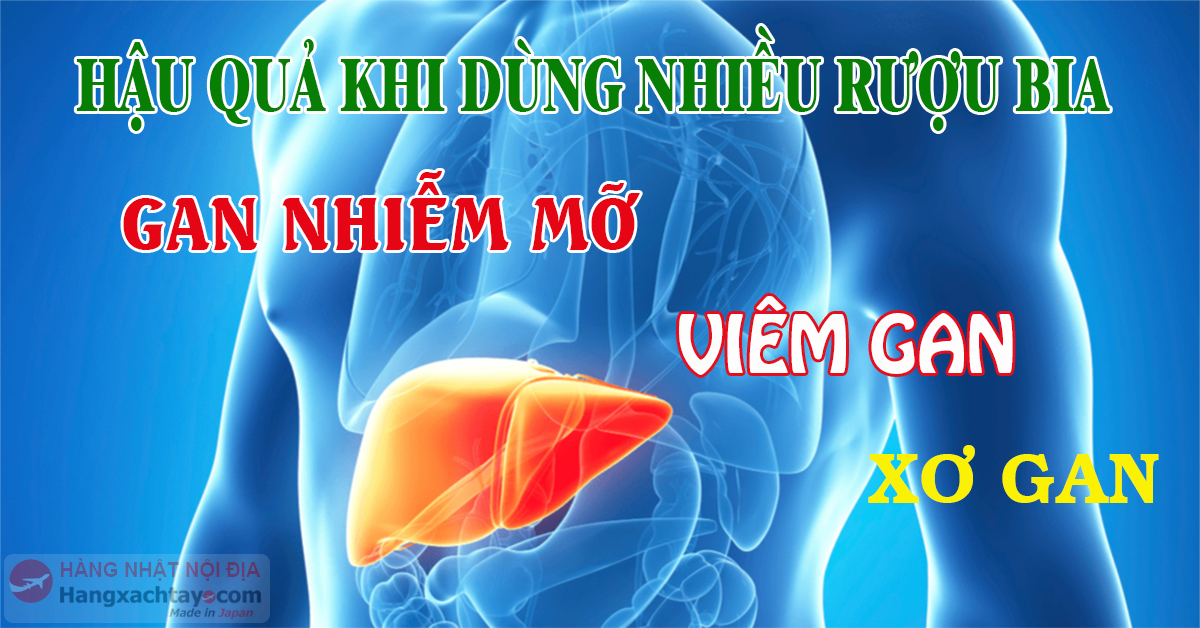 3 HẬU QUẢ LÁ GAN PHẢI GÁNH CHỊU KHI DÙNG RƯỢU BIA NHIỀU