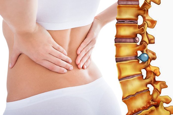Thoái hóa xương khớp