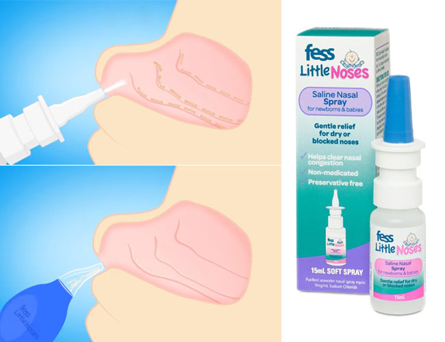 xit-mui-little-noses-spray