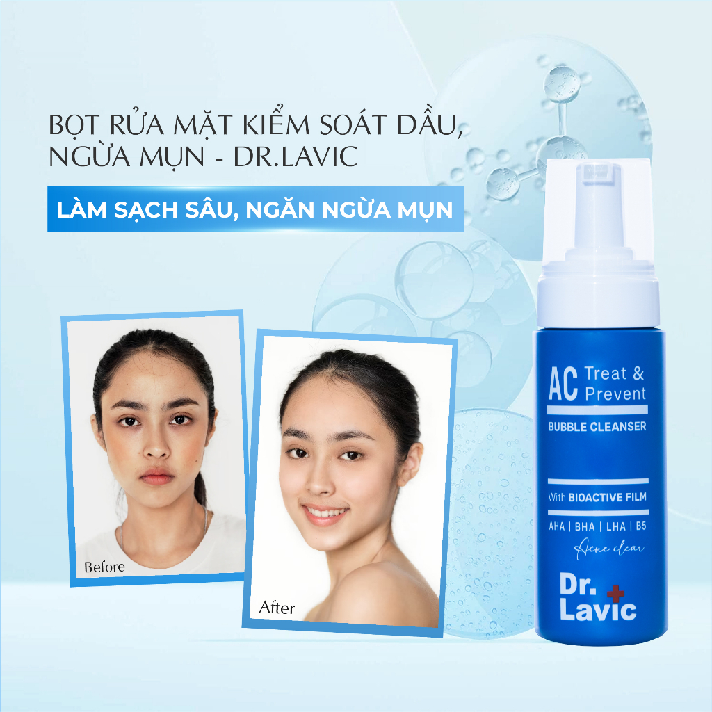 Bọt rửa mặt ngừa mụn Dr.Lavic AC Treat & Prevent Bubble Cleanser kiểm soát dầu ngăn ngừa mụn tái phát 150ml DR956