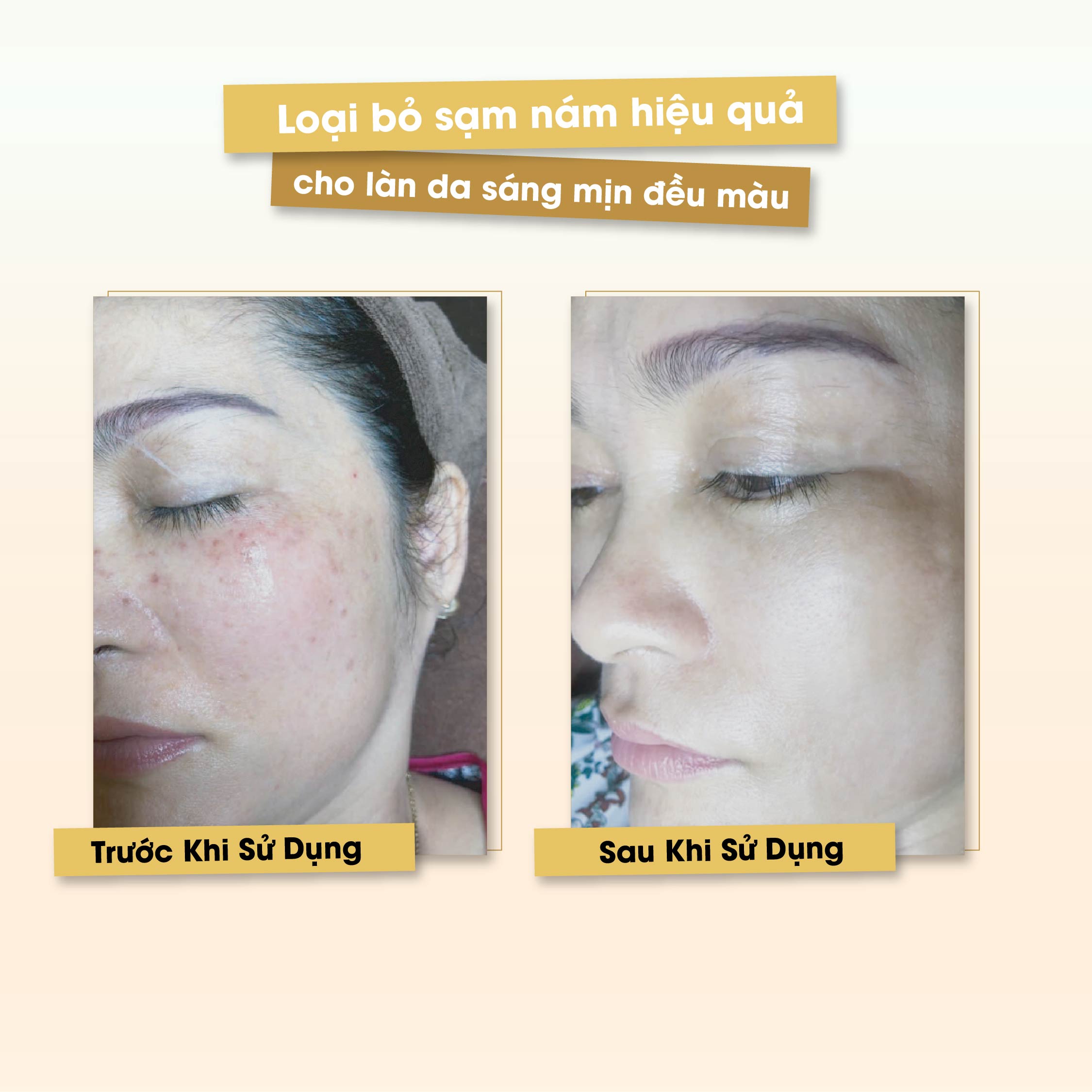 Kem dưỡng da nám Sennio Whitening Tone Up Cream  ban ngày dưỡng trắng da chống lão hoá 50ml SNO 807