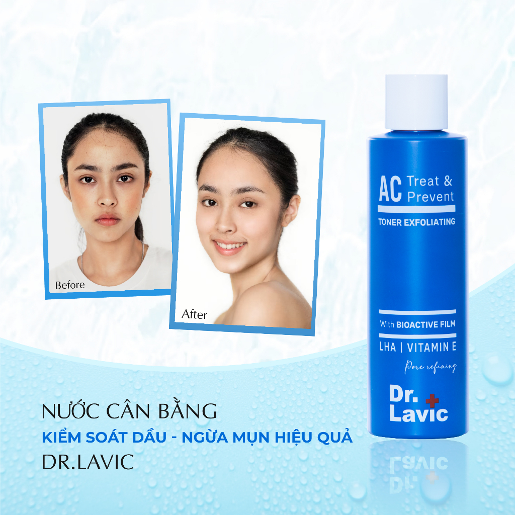 Nước hoa hồng ngừa mụn Dr.Lavic AC Treat & Prevent Toner Exfoliating kiểm soát dầu chống tái phát mụn 180ml DR957