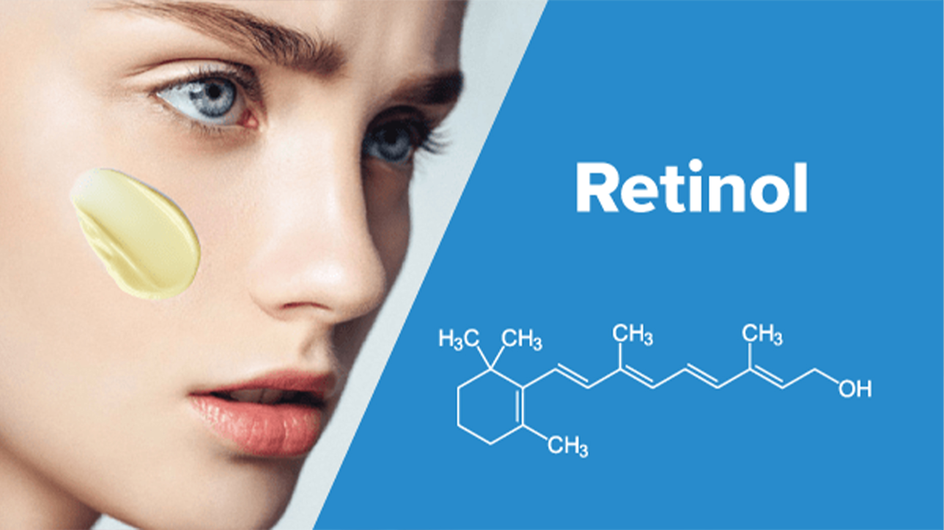 da nhạy cảm có nên dùng retinol