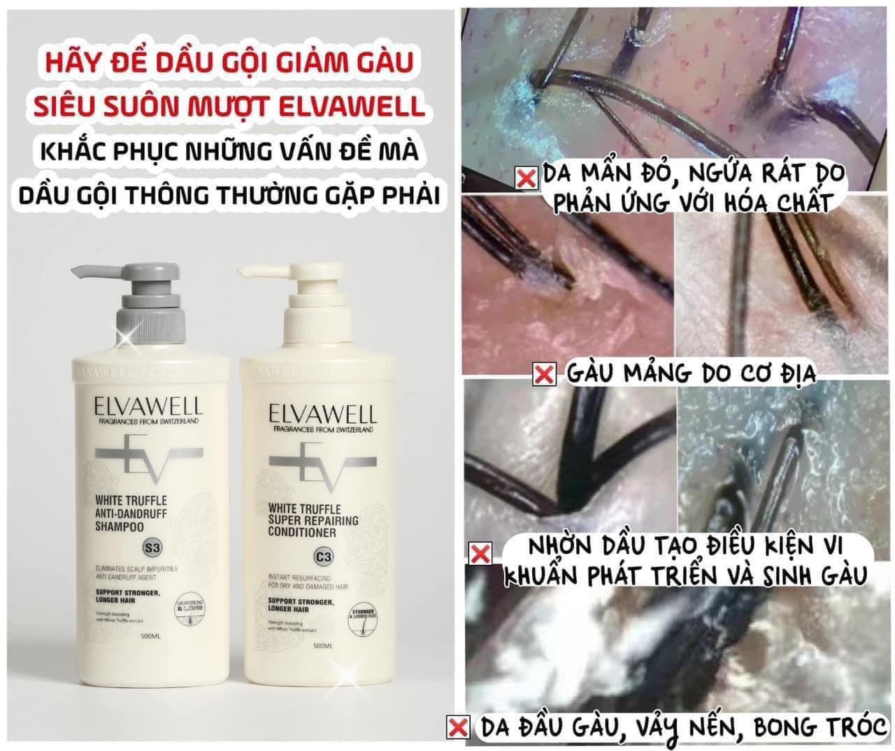 Dầu gội xả Elvawell phục hồi/ kiềm dầu/ trị gầu 500ml-1000ml