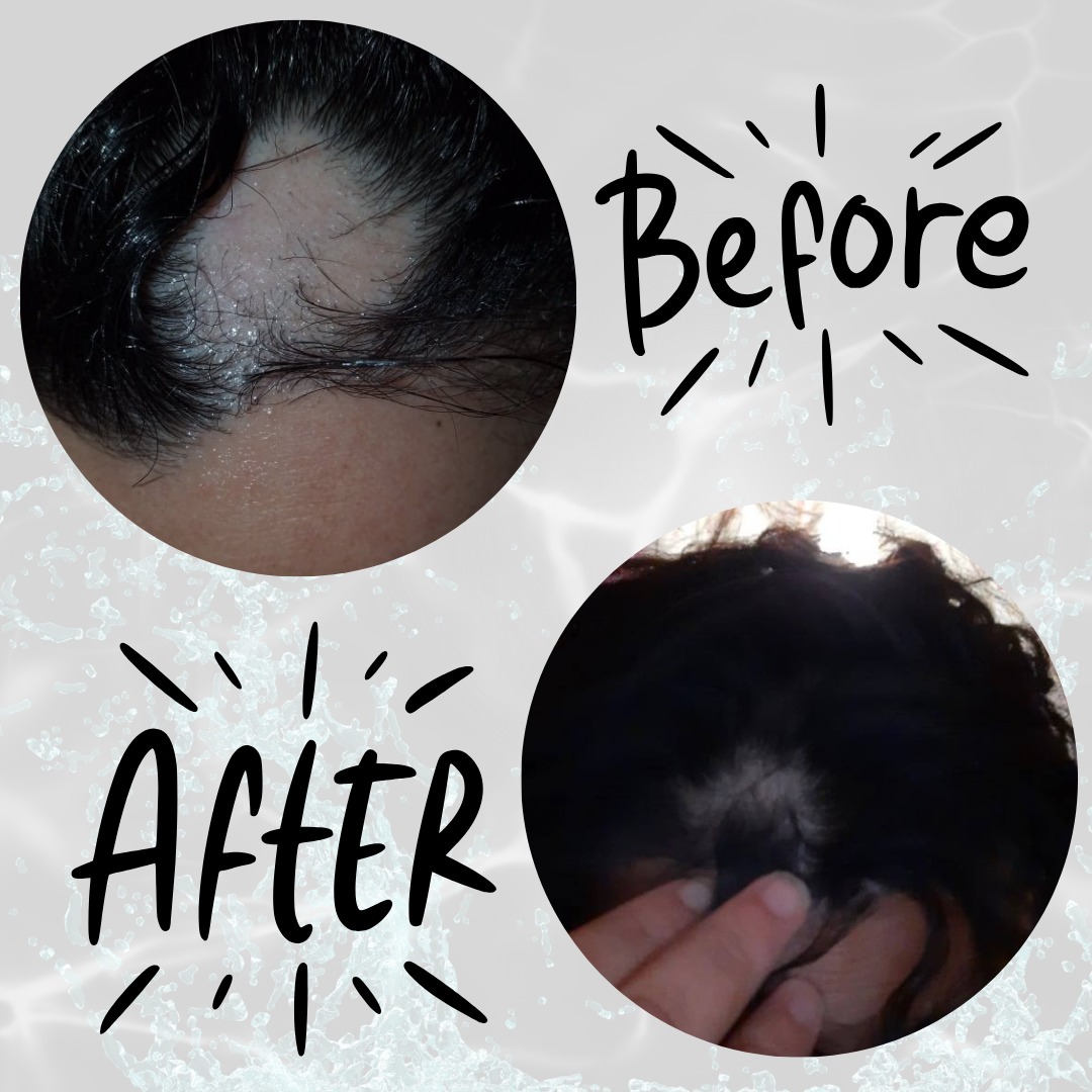 Bộ dầu gội xả CHI Power Plus – Ngăn rụng & Kích thích mọc tóc (CHI Power Plus Hair Renewing)