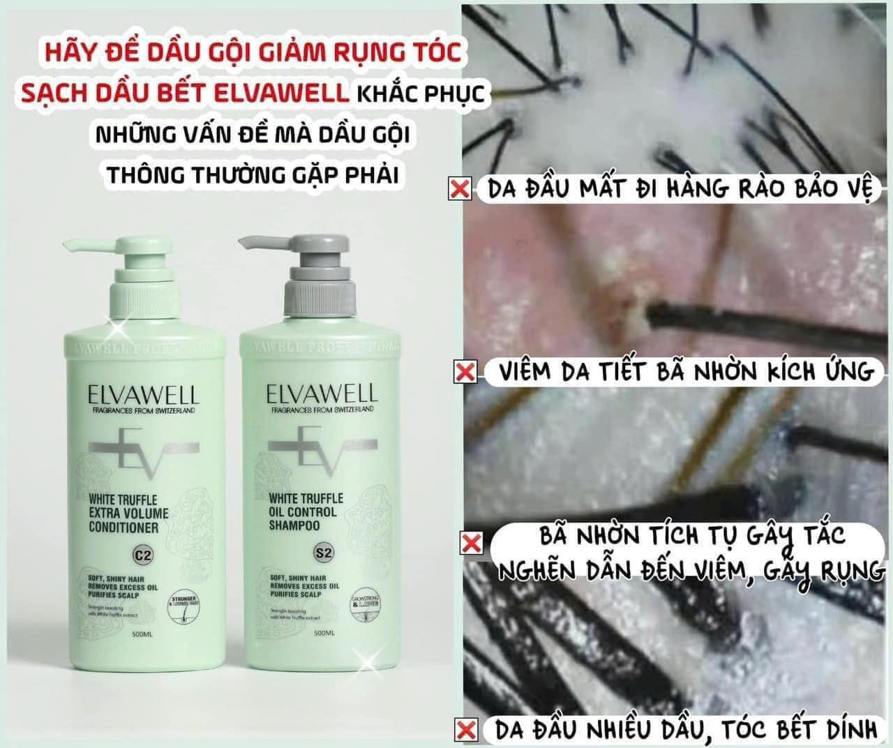 Dầu gội xả Elvawell White Truffle Oil Control Shampoo & Extra Volume Conditioner (Màu xanh) kiềm dầu, tóc mềm bồng bềnh 500ml/1000ml