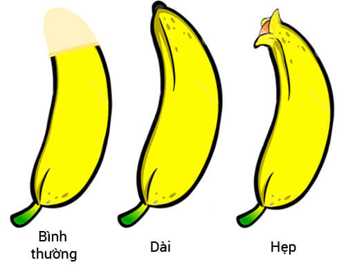 Các trường hợp cần phải cắt bao quy đầu