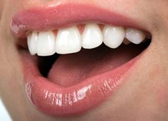 Phục hồi thân răng sau điều trị