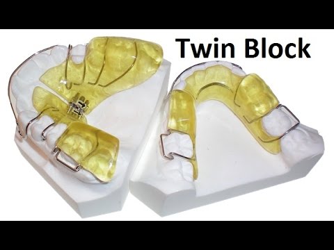 Khí cụ chỉnh nha: twin-block