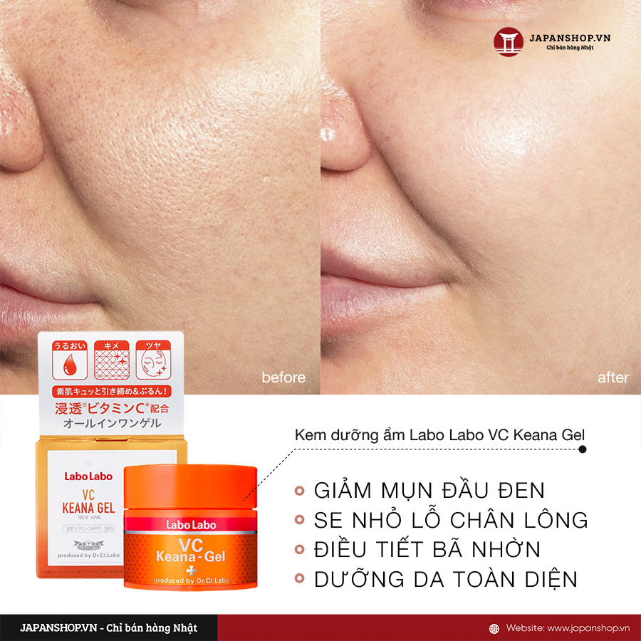 Kem dưỡng ẩm Labo Labo VC Keana Gel 90g có tác dụng se khít lỗ chân lông, cải thiện mụn đầu đen