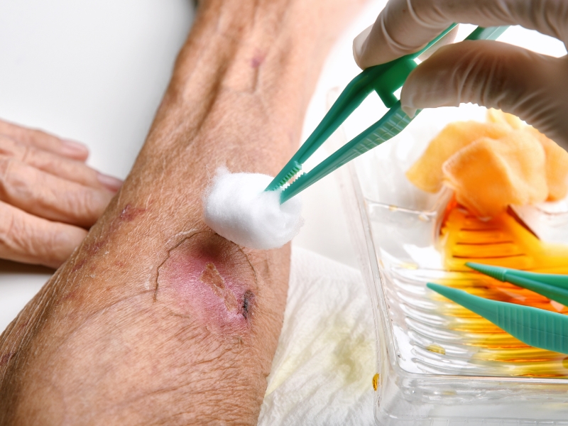 Rửa vết thương tại nhà của Y Tế Bảo Tâm