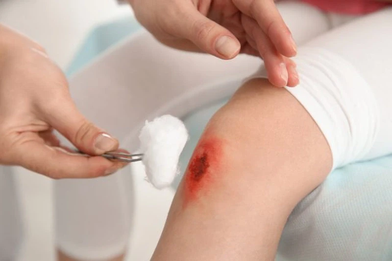 Nhân viên Y Tế Bảo Tâm rửa vết thương chuyên nghiệp, bài bản