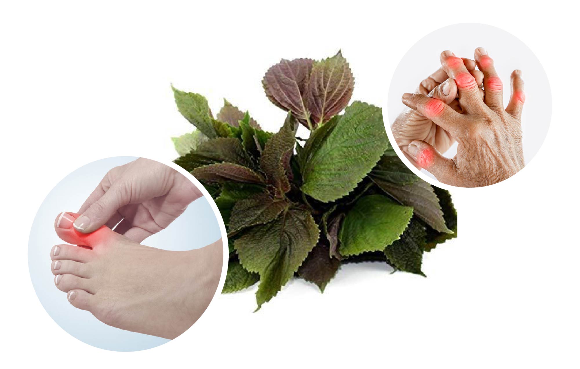 CHẾ ĐỘ DINH DƯỠNG DÀNH CHO NGƯỜI BỆNH GOUT (Gút)