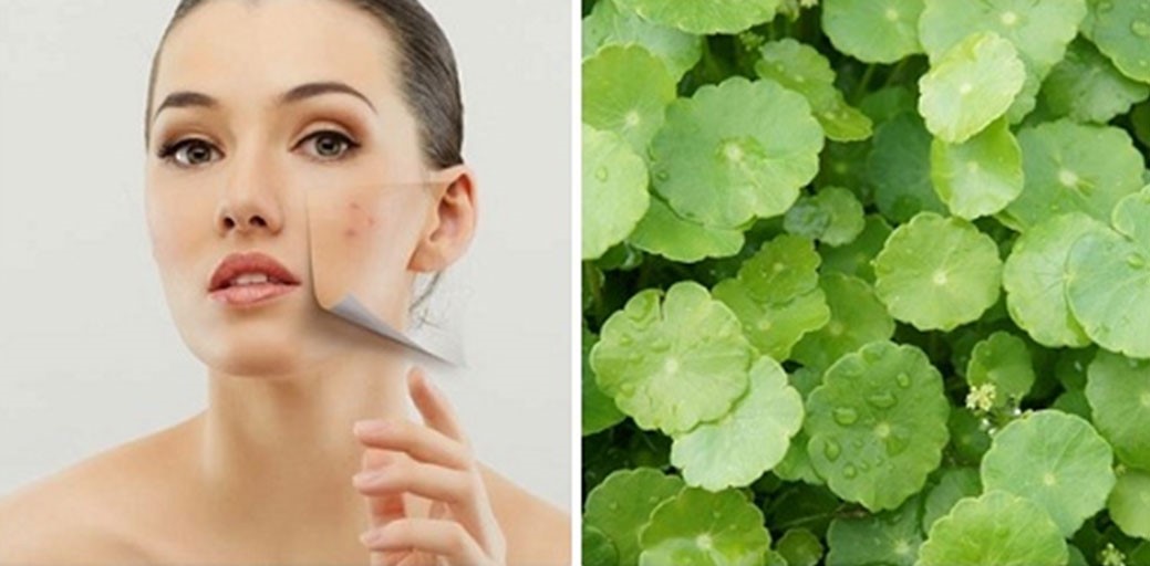 Trị sẹo thâm với bột rau má