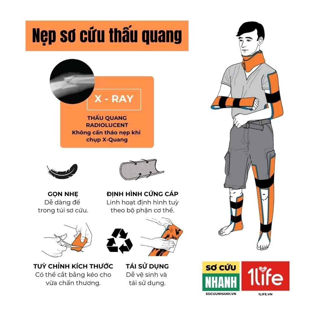 Nẹp Sơ Cứu Thấu Quang SAM Splint – Thiết Bị Không Thể Thiếu Trong Bộ Sơ Cứu Camping