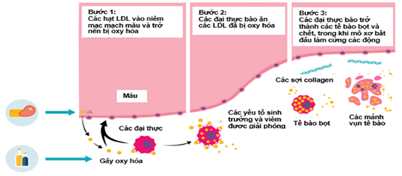 LDL-C nhỏ