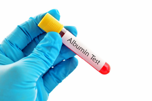 Albumin là gì và công dụng ra sao