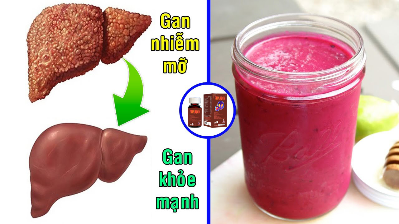 Bệnh gan nhiễm mỡ ăn uống như thế nào đúng cách