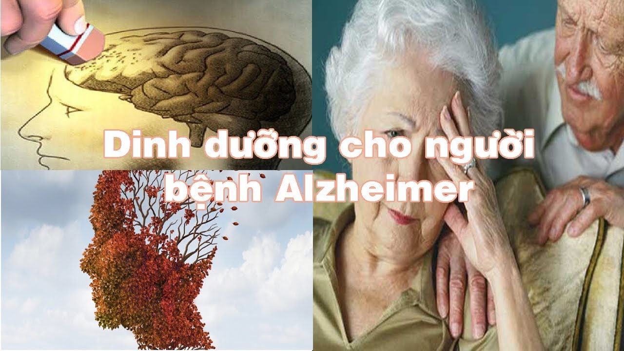 Bệnh hay quên của người lớn tuổi là gì và cách phòng bệnh ra sao 