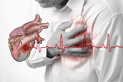 Bệnh nhồi máu cơ tim có nguy hiểm không và cách phòng bệnh ra sao