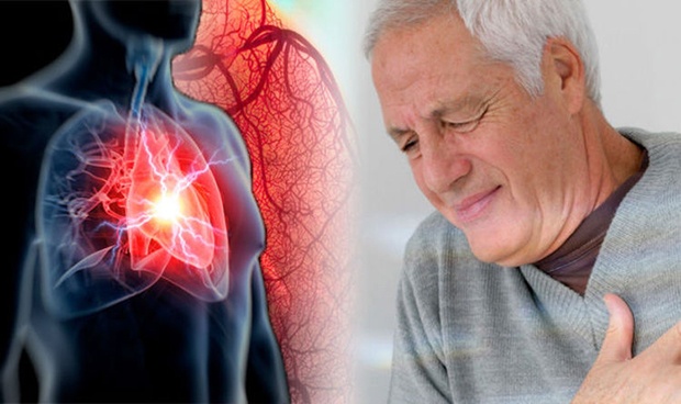 Bệnh nhồi máu cơ tim có nguy hiểm không và cách phòng bệnh ra sao