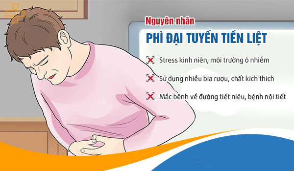 bệnh phì đại tuyến tiền liệt là gì và cách điều trị ra sao