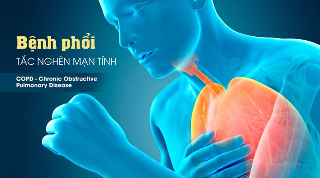 Bệnh phổi tắc nghẽn mạn tính giai đoạn 4 biểu hiện như thế nào