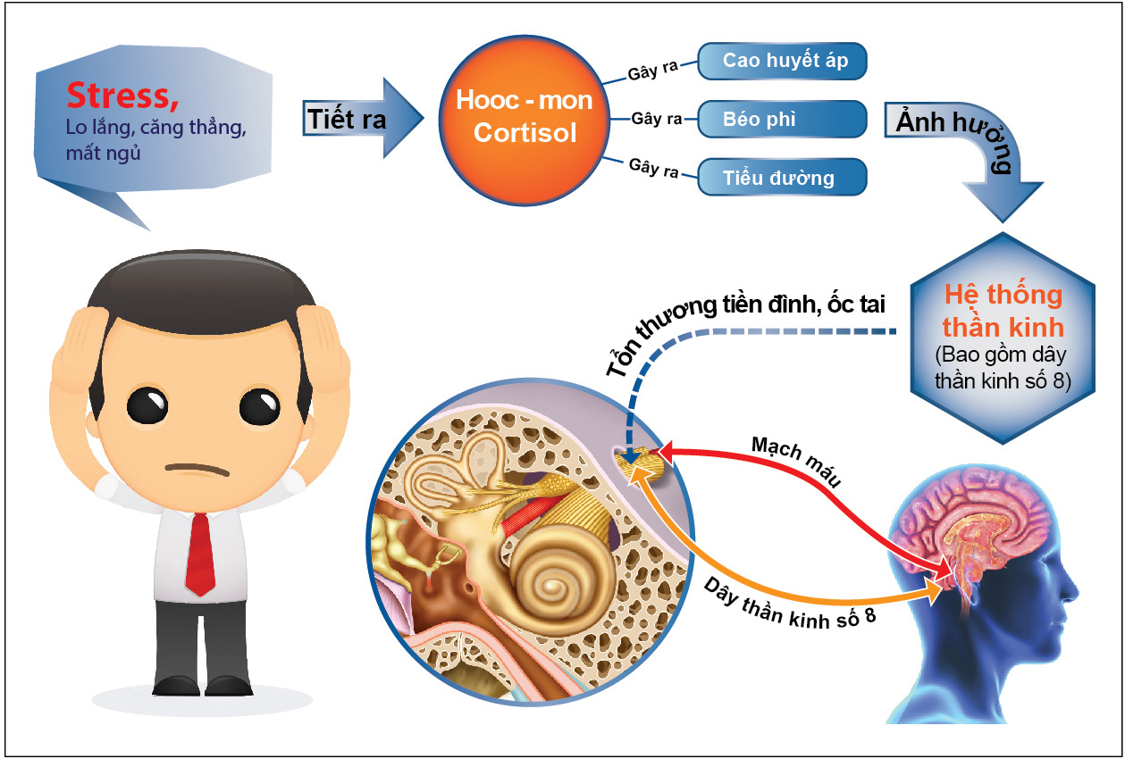 Bệnh rối loạn tiền đình và cách chữa trị như thế nào