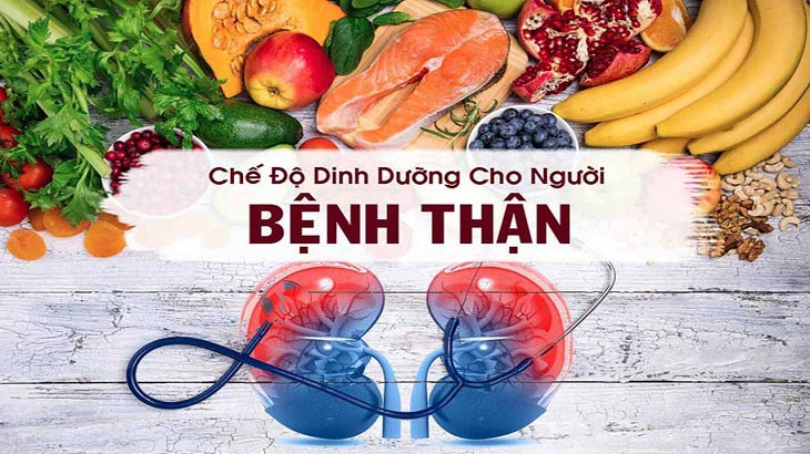 Bệnh sỏi thận cần kiêng những gì