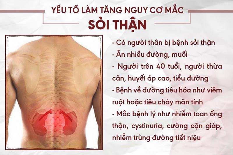 Bệnh sỏi thận có di truyền không