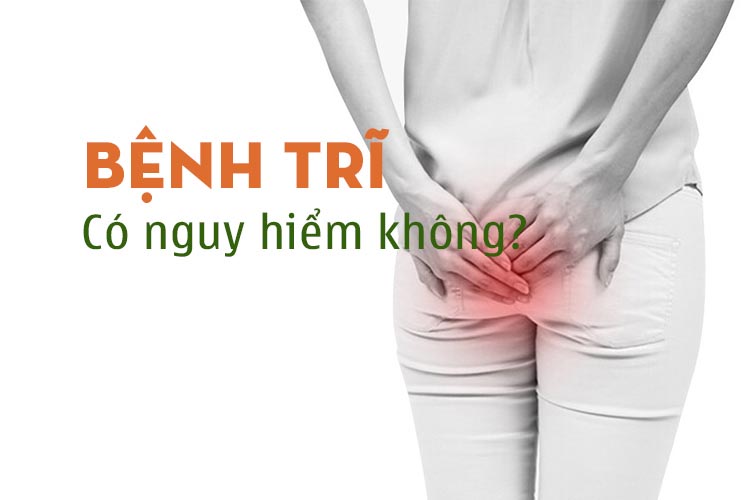Bệnh trĩ có nguy hiểm không và cách phòng ngừa ra sao