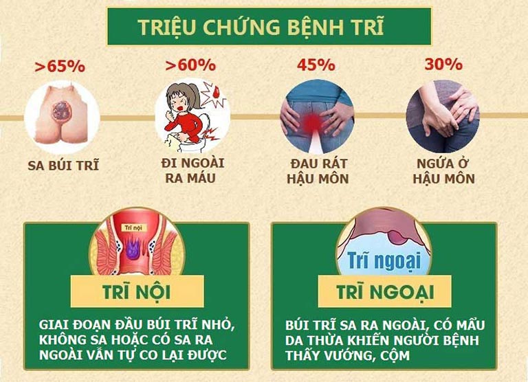Bệnh trĩ có nguy hiểm không và cách phòng ngừa ra sao