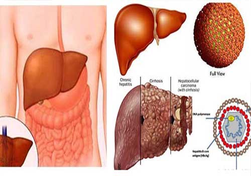 Bệnh viêm gan b có lây không và lây qua đường nào