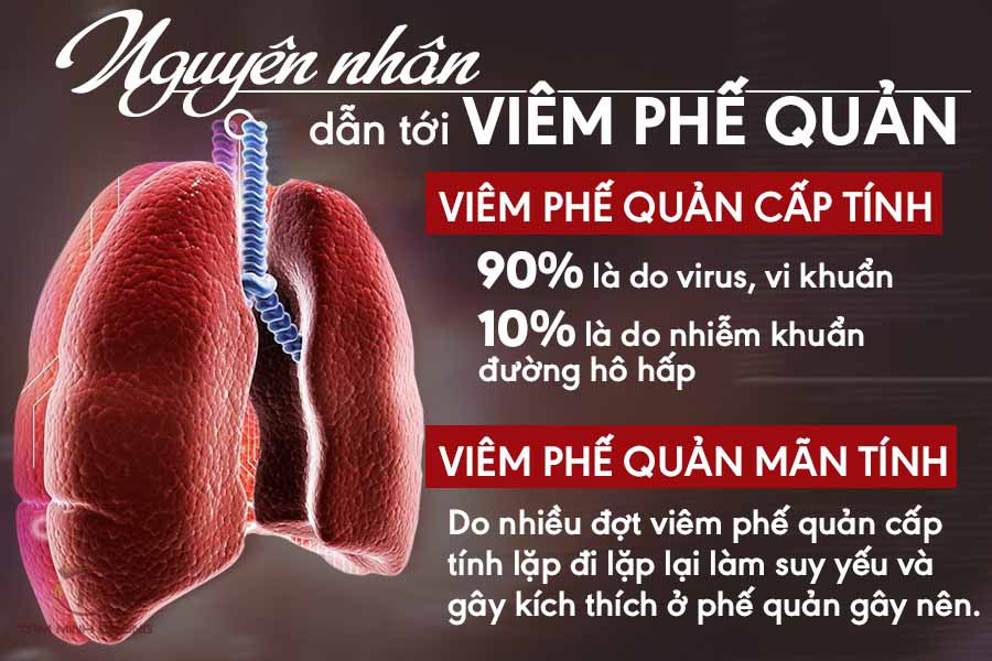 Bệnh viêm phế quản cấp là gì và cách phòng bệnh ra sao