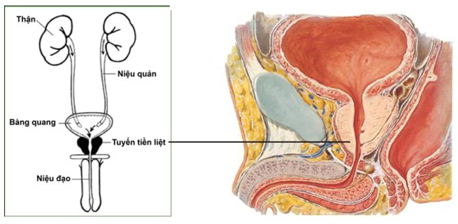Bệnh viêm tuyến tiền liệt ở nam giới là gì