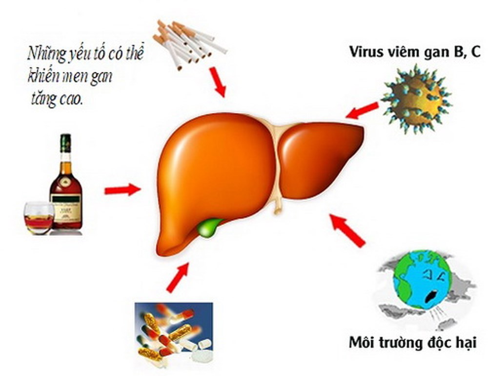 Bị men gan tăng cao nên kiêng gì tốt cho bệnh
