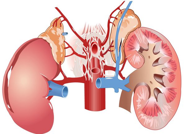 Bị sỏi thận nên uống lá gì tốt an toàn