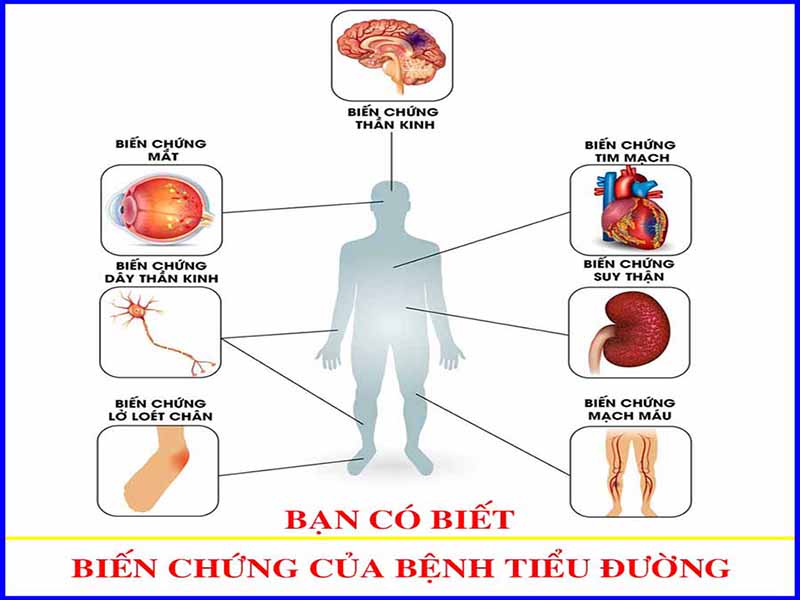 Biến chứng của bệnh tiểu đường với sức khỏe như thế nào