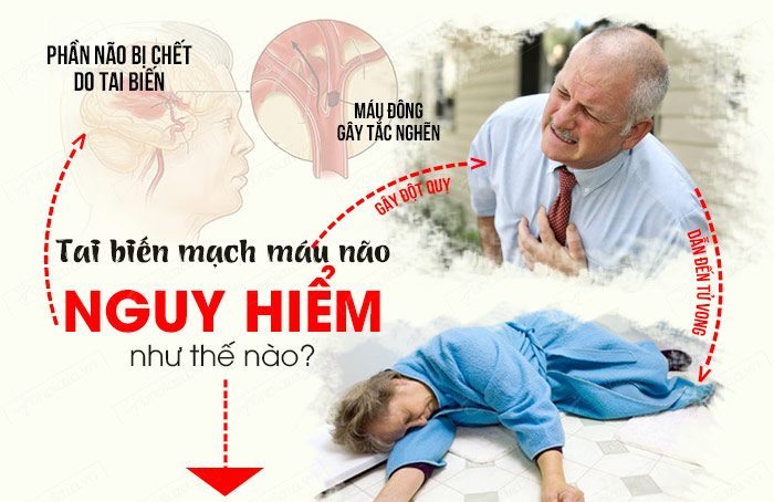 Biến chứng của tai biến mạch máu não là gì và cách phòng bệnh như thế nào