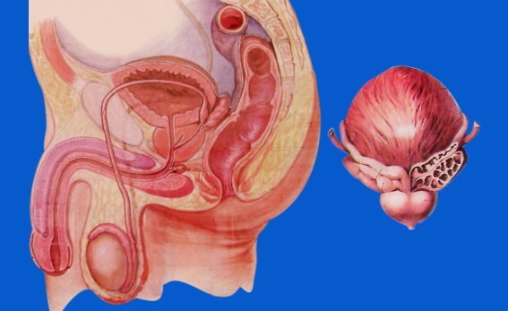 Biến chứng sau mổ u xơ tiền liệt tuyến là gì