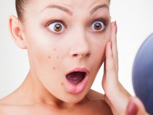 Biểu hiện bị rối loạn nội tiết tố nữ như thế nào