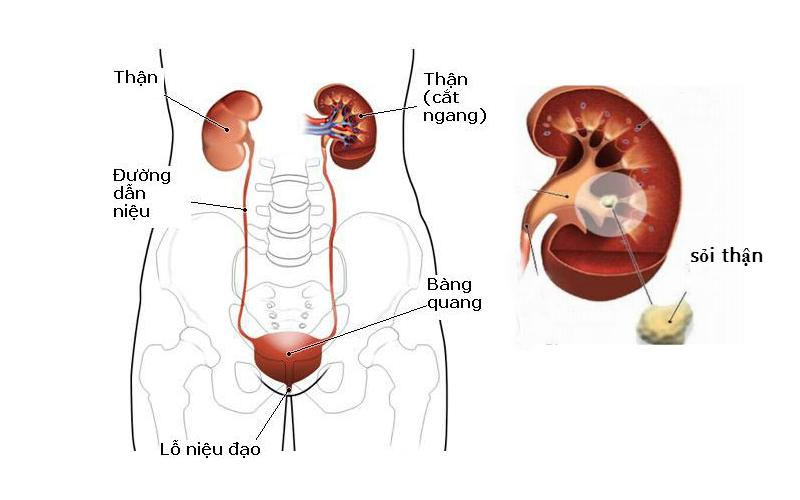 Các bài thuốc dân gian chữa sỏi thận an toàn hiệu quả
